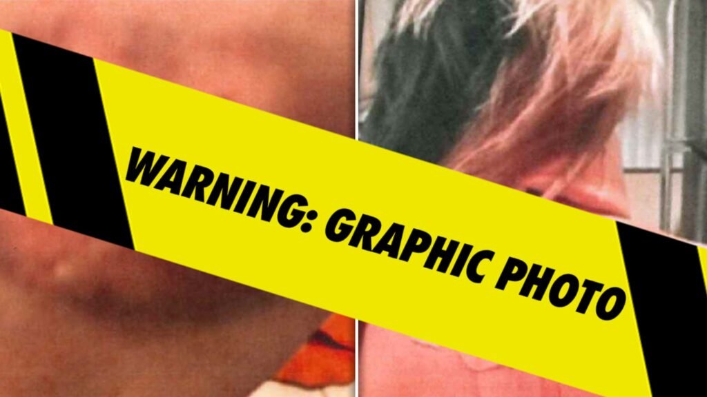 Bryana Bongolan’s Alleged Injury Photos From Diddy Balcony Incident Filed As Evidence